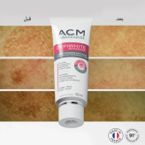 کرم ضد لک ای سی ام ACM دپی وایت اصل فرانسه حجم 40 میل